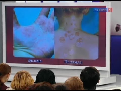 Ekzém na rukou: jak zacházet, typy a příznaky, správné léky